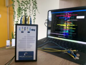 Système neurofeedback NeurOptimal Strasbourg Illkirch