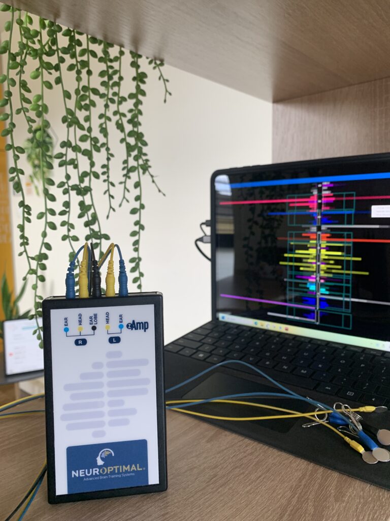 neurofeedback dynamique NeurOptimal Strasbourg Illkirch